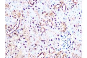 Immunohistochemistry of paraffin-embedded mouse kidney using PSM Rabbit mAb (ABIN7269600) at dilution of 1:100 (40x lens). (PSMA3 anticorps)