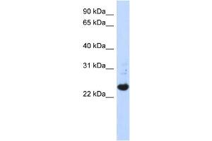 WB Suggested Anti-C21orf56 Antibody Titration:  0. (C21ORF56 anticorps  (N-Term))