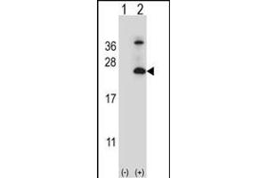Western blot analysis of TSN6 (arrow) using rabbit polyclonal TSN6 Antibody (C-term) (ABIN6242668 and ABIN6579053). (Tetraspanin 6 anticorps  (C-Term))