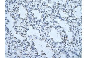 Rabbit Anti-THOC1 Antibody       Paraffin Embedded Tissue:  Human alveolar cell   Cellular Data:  Epithelial cells of renal tubule  Antibody Concentration:   4. (THOC1 anticorps  (C-Term))