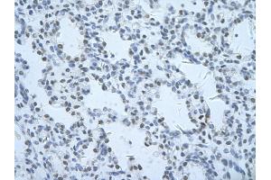 Rabbit Anti-THOC1 Antibody       Paraffin Embedded Tissue:  Human alveolar cell   Cellular Data:  Epithelial cells of renal tubule  Antibody Concentration:   4. (THOC1 anticorps  (C-Term))