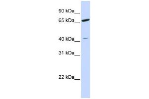 WB Suggested Anti-ZNF334 Antibody Titration: 0.