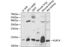 Western blot analysis of extracts of various cell lines, using KLRC4 antibody (ABIN7268115) at 1:1000 dilution. (KLRC4 anticorps  (AA 1-55))