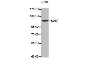 Western Blotting (WB) image for anti-Calpastatin (CAST) antibody (ABIN2650901) (Calpastatin anticorps)