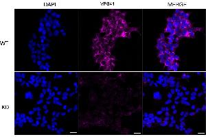 Immunocytochemical staining of HeLa cells using VPS41 antibody (ABIN7800815), 1:1,000), Top panel: wild-type (WT), Bottom panal: VPS41 shRNA knockdown (KD). (Recombinant VPS41 anticorps)