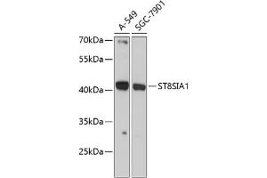 Western blot analysis of extracts of various cell lines, using ST8SI antibody (ABIN6132687, ABIN6148541, ABIN6148542 and ABIN6225056) at 1:3000 dilution. (ST8SIA1 anticorps  (AA 49-270))