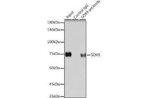 Immunoprecipitation analysis of 200 μg extracts of HeLa cells using 3 μg SOX9 antibody (ABIN7270577). (SOX9 anticorps)