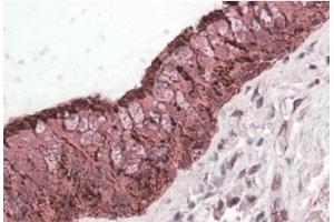 AP20183PU-N ALDH3A1 antibody staining of paraffin embedded Human Lung at 3. (ALDH3A1 anticorps  (C-Term))