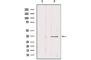 Western blot analysis of extracts from Mouse Myeloma cell, using SOX12 Antibody. (SOX12 anticorps  (Internal Region))