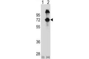Western Blotting (WB) image for anti-Alveolar Soft Part Sarcoma Chromosome Region, Candidate 1 (ASPSCR1) antibody (ABIN2998788)