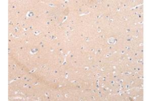 The image on the left is immunohistochemistry of paraffin-embedded Human brain tissue using ABIN7193105(ZNF106 Antibody) at dilution 1/20, on the right is treated with synthetic peptide.