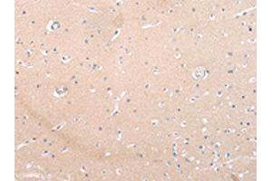 The image on the left is immunohistochemistry of paraffin-embedded Human brain tissue using ABIN7193105(ZNF106 Antibody) at dilution 1/20, on the right is treated with synthetic peptide. (ZNF16 anticorps)