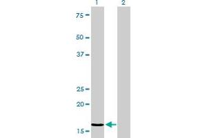 Western Blot analysis of NME2 expression in transfected 293T cell line by NME2 monoclonal antibody (M01), clone 4B7-3F12.