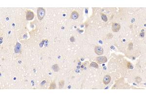 Detection of TF in Bovine Cerebrum Tissue using Polyclonal Antibody to Tissue Factor (TF)