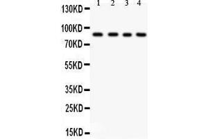 Anti- IKK beta antibody, Western blotting All lanes: Anti IKK beta  at 0.