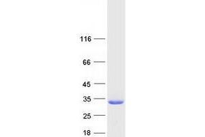 Validation with Western Blot