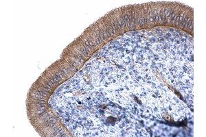 IHC-P Image Alpha-catulin antibody [N3C2], Internal detects Alpha-catulin protein at cytoplasm on mouse cervix by immunohistochemical analysis. (CTNNAL1 anticorps  (Internal Region))