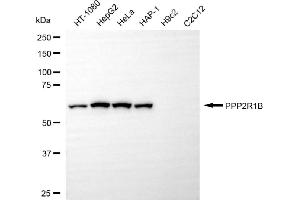 Western blotting analysis using PPP2R1B antibody (ABIN7800022).