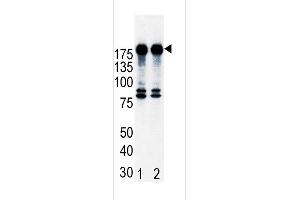 Western blot analysis of ErbB2 (arrow) in T47D cell lysates, either noninduced (Lane 1) or induced with HRG (Lane 2). (ErbB2/Her2 anticorps  (N-Term))