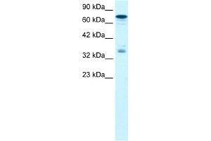 WB Suggested Anti-NFKBIB Antibody Titration:  1. (NFKBIB anticorps  (N-Term))
