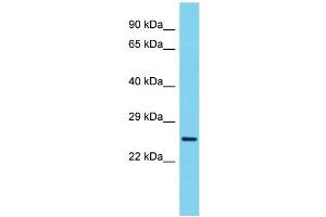Host: Rabbit Target Name: VCX3A Sample Type: ACHN Whole Cell lysates Antibody Dilution: 1. (VCX3A anticorps  (N-Term))