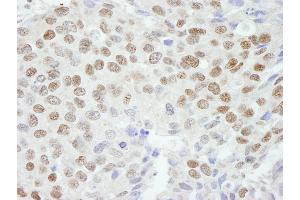 Immunohistochemistry (IHC) image for anti-Zinc Finger Protein 295 (ZNF295) (AA 875-925) antibody (ABIN7448882)