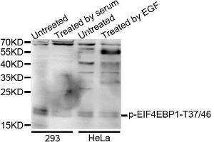 Western blot analysis of extracts of various cells, using Phospho-EIF4EBP1-T37/46 antibody (ABIN5995638). (eIF4EBP1 anticorps  (pThr36))