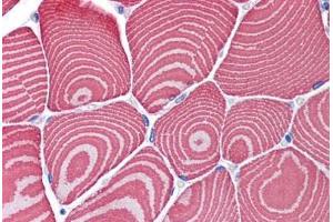 Human Skeletal Muscle: Formalin-Fixed, Paraffin-Embedded (FFPE)
