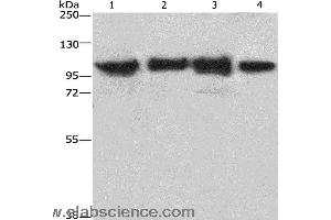 Western blot analysis of Lovo cell and mouse kidney tissue, 231 and hepG2 cell, using ACTN4 Polyclonal Antibody at dilution of 1:485 (alpha Actinin 4 anticorps)