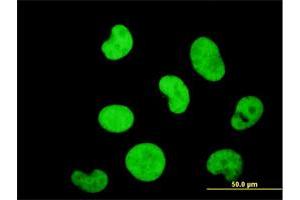 Immunofluorescence of monoclonal antibody to ZNF207 on HeLa cell. (ZNF207 anticorps  (AA 1-110))
