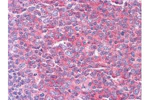 Immunohistochemical analysis of paraffin-embedded human Tonsil tissues using KARS mouse mAb
