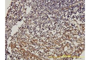 Immunoperoxidase of monoclonal antibody to CD58 on formalin-fixed paraffin-embedded human tonsil.