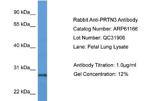 Western Blotting (WB) image for anti-Proteinase 3 (PRTN3) (N-Term) antibody (ABIN2788703) (PRTN3 anticorps  (N-Term))