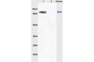 Lane 1: mouse liver lysates Lane 2: mouse lung lysates probed with Anti Phospho-TrkA (Tyr490) /TrkB (Tyr516) Polyclonal Antibody, Unconjugated (ABIN746603) at 1:200 in 4 °C. (TRKA anticorps  (pTyr496))