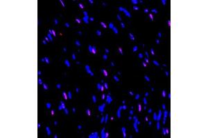 Immunofluorescence of paraffin embedded rat heart using SOCS7 (ABIN7075765) at dilution of 1:650 (300x lens) (SOCS7 anticorps)