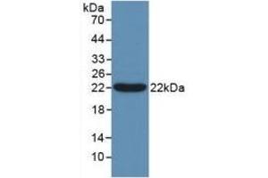 Detection of Recombinant Bcl2L2, Human using Polyclonal Antibody to B-Cell CLL/Lymphoma 2 Like Protein 2 (Bcl2L2) (BCL2L2 anticorps  (AA 2-193))