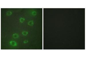 Immunofluorescence (IF) image for anti-Pentraxin 3 (PTX3) (N-Term) antibody (ABIN1849270) (PTX3 anticorps  (N-Term))