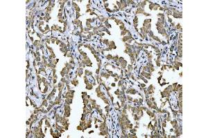 IHC analysis of NDUFV2 using anti-NDUFV2 antibody (ABIN7599154). (NDUFV2 anticorps  (AA 1-249))
