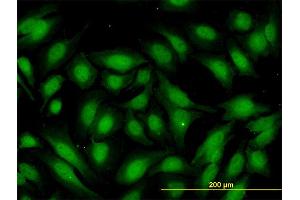 Immunofluorescence of monoclonal antibody to RBBP9 on HeLa cell.