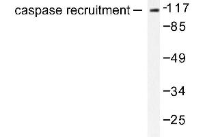 Image no. 1 for anti-Caspase Recruitment Domain Family, Member 6 (CARD6) antibody (ABIN265333) (CARD6 anticorps)