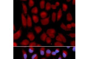 Immunofluorescence analysis of U2OS cells using TAP2 Polyclonal Antibody (TAP2 anticorps)
