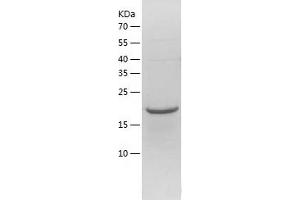 Western Blotting (WB) image for Magnesium-Dependent Phosphatase 1 (MDP1) (AA 1-176) protein (His tag) (ABIN7123827)