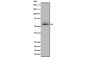 Western blot analysis of CD147 expression in Jurkat cell lysate. (Recombinant CD147 anticorps)