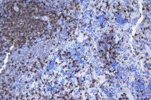 IHC analysis of CD5 using anti-CD5 antibody (ABIN7600839). (CD5 anticorps  (AA 24-494))