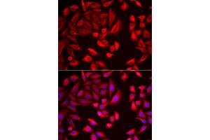 Immunofluorescence analysis of HeLa cell using CCT2 antibody. (CCT2 anticorps)
