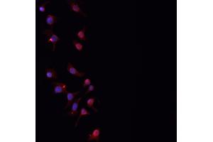 ABIN6276842 staining HepG2? (PLGF anticorps  (Internal Region))