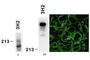 Reactivity of laminin alpha4 chain specific monoclonal antibody 3H2 on human platelet lysate by Western blotting (reducing, R and nonreducing, NR conditions) and on human embryonic kidney preparation
