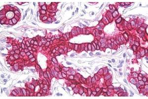 Anti-Cytokeratin 8 / Keratin 8 antibody IHC staining of human breast. (KRT8 anticorps  (AA 434-483))