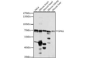 Western blot analysis of extracts of various cell lines, using GNL1 antibody (ABIN7267543) at 1:1000 dilution. (GNL1 anticorps  (AA 1-180))