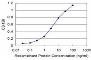 Detection limit for recombinant GST tagged RCV1 is approximately 0. (Recoverin anticorps  (AA 101-199))